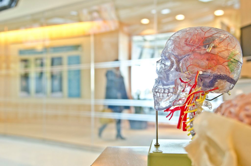 Stroke recovery